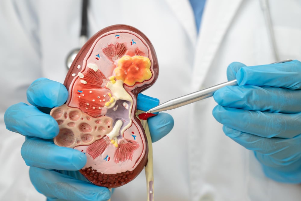 nephrology