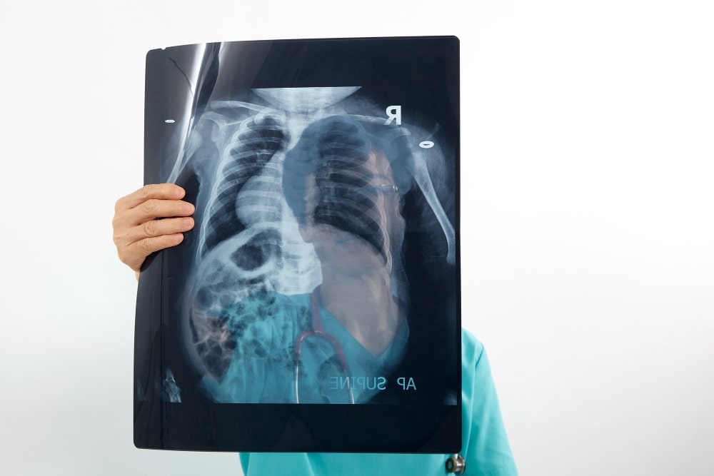 x-ray
